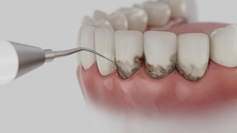 Reliable Dental Implants contractor in Sunnyvale, CA by Smile Center Dentistry